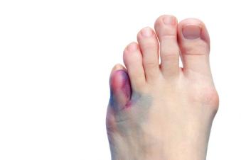 r4tqv5svbmlfc0pgolvafep265FA fracture2